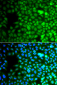 ZNF195 Antibody - Immunofluorescence analysis of A549 cells.