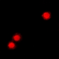 ZNF195 Antibody - Immunofluorescent analysis of ZNF195 staining in A549 cells. Formalin-fixed cells were permeabilized with 0.1% Triton X-100 in TBS for 5-10 minutes and blocked with 3% BSA-PBS for 30 minutes at room temperature. Cells were probed with the primary antibody in 3% BSA-PBS and incubated overnight at 4 deg C in a humidified chamber. Cells were washed with PBST and incubated with a DyLight 594-conjugated secondary antibody (red) in PBS at room temperature in the dark.