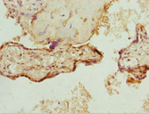 ZNF195 Antibody - Immunohistochemistry of paraffin-embedded human placenta tissue at dilution 1:100