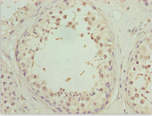 ZNF20 Antibody - Immunohistochemistry of paraffin-embedded human testis tissue at dilution 1:100