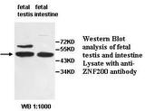 ZNF200 Antibody