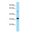 ZNF202 Antibody - Western blot of Mouse Kidney. Zfp202 antibody dilution 1.0 ug/ml.  This image was taken for the unconjugated form of this product. Other forms have not been tested.