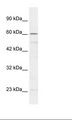 ZNF212 Antibody - Jurkat Cell Lysate.  This image was taken for the unconjugated form of this product. Other forms have not been tested.