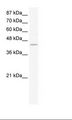 ZNF212 Antibody - K562 Cell Lysate.  This image was taken for the unconjugated form of this product. Other forms have not been tested.