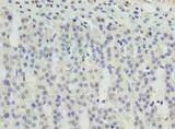 ZNF215 Antibody - Immunohistochemistry of paraffin-embedded human adrenal gland tissue using antibody at dilution of 1:100.