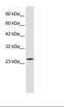 ZNF22 Antibody - Jurkat Cell Lysate.  This image was taken for the unconjugated form of this product. Other forms have not been tested.