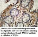 ZNF223 Antibody