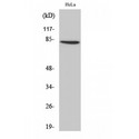 ZNF225 Antibody - Western blot of ZNF225 antibody