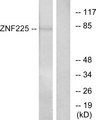 ZNF225 Antibody - Western blot analysis of lysates from HeLa cells, using ZNF225 Antibody. The lane on the right is blocked with the synthesized peptide.