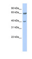 ZNF226 Antibody - ZNF226 antibody Western blot of Fetal Pancreas lysate. This image was taken for the unconjugated form of this product. Other forms have not been tested.
