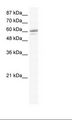 ZNF232 Antibody - Jurkat Cell Lysate.  This image was taken for the unconjugated form of this product. Other forms have not been tested.