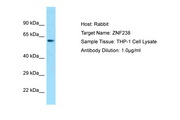 ZNF238 Antibody -  This image was taken for the unconjugated form of this product. Other forms have not been tested.