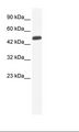 ZNF239 Antibody - Jurkat Cell Lysate.  This image was taken for the unconjugated form of this product. Other forms have not been tested.