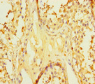 ZNF252P-AS1 Antibody - Immunohistochemistry of paraffin-embedded human testis tissue using ZNF252P-AS1 Antibody at dilution of 1:100