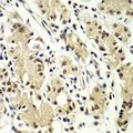 ZNF264 Antibody - Immunohistochemistry of paraffin-embedded human gastric tissue.