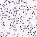 ZNF264 Antibody