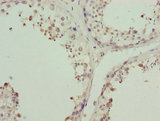 ZNF264 Antibody - Immunohistochemistry of paraffin-embedded human testis tissue using ZNF264 Antibody at dilution of 1:100