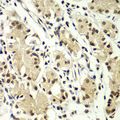 ZNF264 Antibody - Immunohistochemistry of paraffin-embedded human gastric using ZNF264 antibody at dilution of 1:100 (40x lens).