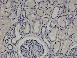 ZNF266 Antibody - Immunoperoxidase of monoclonal antibody to ZNF266 on formalin-fixed paraffin-embedded human kidney. [antibody concentration 1.5 ug/ml]