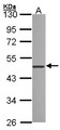 ZNF277 Antibody - Sample (30 ug of whole cell lysate). A:293T. 10% SDS PAGE. ZNF277 antibody diluted at 1:1000.