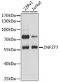 ZNF277 Antibody - Western blot analysis of extracts of various cell lines, using ZNF277 antibody at 1:3000 dilution. The secondary antibody used was an HRP Goat Anti-Rabbit IgG (H+L) at 1:10000 dilution. Lysates were loaded 25ug per lane and 3% nonfat dry milk in TBST was used for blocking. An ECL Kit was used for detection and the exposure time was 10s.