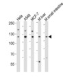 ZNF281 / Zfp281 Antibody - Western blot of lysates from HeLa, A549, MCF-7 cell line, mouse liver, mouse small intestine tissue lysate (from left to right), using ZNF281 antibody diluted at 1:1000 at each lane. A goat anti-rabbit IgG H&L (HRP) at 1:10000 dilution was used as the secondary antibody. Lysates at 20 ug per lane.
