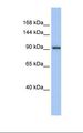 ZNF295 Antibody - Fetal muscle lysate. Antibody concentration: 1.0 ug/ml. Gel concentration: 6-18%.  This image was taken for the unconjugated form of this product. Other forms have not been tested.