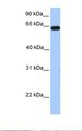 ZNF296 / ZNF342 Antibody - Transfected 293T cell lysate. Antibody concentration: 1.0 ug/ml. Gel concentration: 12%.  This image was taken for the unconjugated form of this product. Other forms have not been tested.