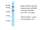 ZNF311 Antibody -  This image was taken for the unconjugated form of this product. Other forms have not been tested.