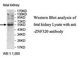 ZNF320 Antibody