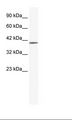 ZNF322 Antibody - Jurkat Cell Lysate.  This image was taken for the unconjugated form of this product. Other forms have not been tested.