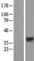 ZNF330 Protein - Western validation with an anti-DDK antibody * L: Control HEK293 lysate R: Over-expression lysate
