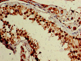 ZNF331 Antibody - Immunohistochemistry image of paraffin-embedded human testis tissue at a dilution of 1:100