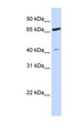ZNF334 Antibody - ZNF334 antibody Western blot of HeLa lysate. This image was taken for the unconjugated form of this product. Other forms have not been tested.