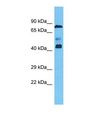 ZNF362 Antibody - Western blot of Human Ovary Tumor. ZNF362 antibody dilution 1.0 ug/ml.  This image was taken for the unconjugated form of this product. Other forms have not been tested.