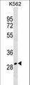 ZNF365 Antibody - ZNF365 Antibody western blot of K562 cell line lysates (35 ug/lane). The ZNF365 antibody detected the ZNF365 protein (arrow).