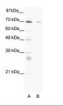 ZNF37A Antibody - A: Marker, B: HepG2 Cell Lysate.  This image was taken for the unconjugated form of this product. Other forms have not been tested.