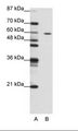 ZNF382 Antibody - A: Marker, B: Jurkat Cell Lysate.  This image was taken for the unconjugated form of this product. Other forms have not been tested.
