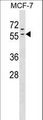 ZNF383 Antibody - ZNF383 Antibody western blot of MCF-7 cell line lysates (35 ug/lane). The ZNF383 antibody detected the ZNF383 protein (arrow).