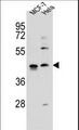 ZNF384 Antibody - ZNF384 Antibody western blot of MCF-7,HeLa cell line lysates (35 ug/lane). The ZNF384 antibody detected the ZNF384 protein (arrow).
