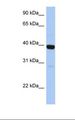 ZNF385B / ZNF533 Antibody - Fetal liver lysate. Antibody concentration: 1.0 ug/ml. Gel concentration: 12%.  This image was taken for the unconjugated form of this product. Other forms have not been tested.