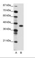 ZNF396 Antibody - A: Marker, B: Jurkat Cell Lysate.  This image was taken for the unconjugated form of this product. Other forms have not been tested.