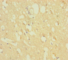 ZNF396 Antibody - Immunohistochemistry of paraffin-embedded human brain tissue using ZNF396 Antibody at dilution of 1:100