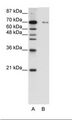 ZNF398 Antibody - A: Marker, B: HepG2 Cell Lysate.  This image was taken for the unconjugated form of this product. Other forms have not been tested.