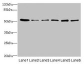 ZNF398 Antibody - Western blot All lanes: ZNF398 antibody at 3µg/ml Lane 1: 293T whole cell lysate Lane 2: Hela whole cell lysate Lane 3: HepG2 whole cell lysate Lane 4: Jurkat whole cell lysate Lane 5: MCF-7 whole cell lysate Lane 6: Caco-2 whole cell lysate Lane 7: A549 whole cell lysate Secondary Goat polyclonal to rabbit IgG at 1/10000 dilution Predicted band size: 72, 53 kDa Observed band size: 53 kDa