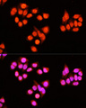 ZNF408 / PRDM17 Antibody - Immunofluorescence analysis of Hela cells using ZNF408 antibody at dilution of 1:100 (40x lens). Blue: DAPI for nuclear staining.