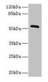 ZNF410 Antibody - Western blot All lanes: ZNF410 antibody at 3µg/ml + Mouse brain tissue Secondary Goat polyclonal to rabbit IgG at 1/10000 dilution Predicted band size: 53, 30, 48, 45, 56 kDa Observed band size: 53 kDa