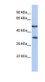 ZNF414 Antibody - ZNF414 antibody Western blot of HepG2 cell lysate. This image was taken for the unconjugated form of this product. Other forms have not been tested.