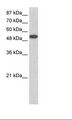 ZNF416 Antibody - 293T Cell Lysate.  This image was taken for the unconjugated form of this product. Other forms have not been tested.