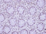 ZNF418 Antibody - IHC of paraffin-embedded Normal colon, using ZNF418 antibody at 1:250 dilution.